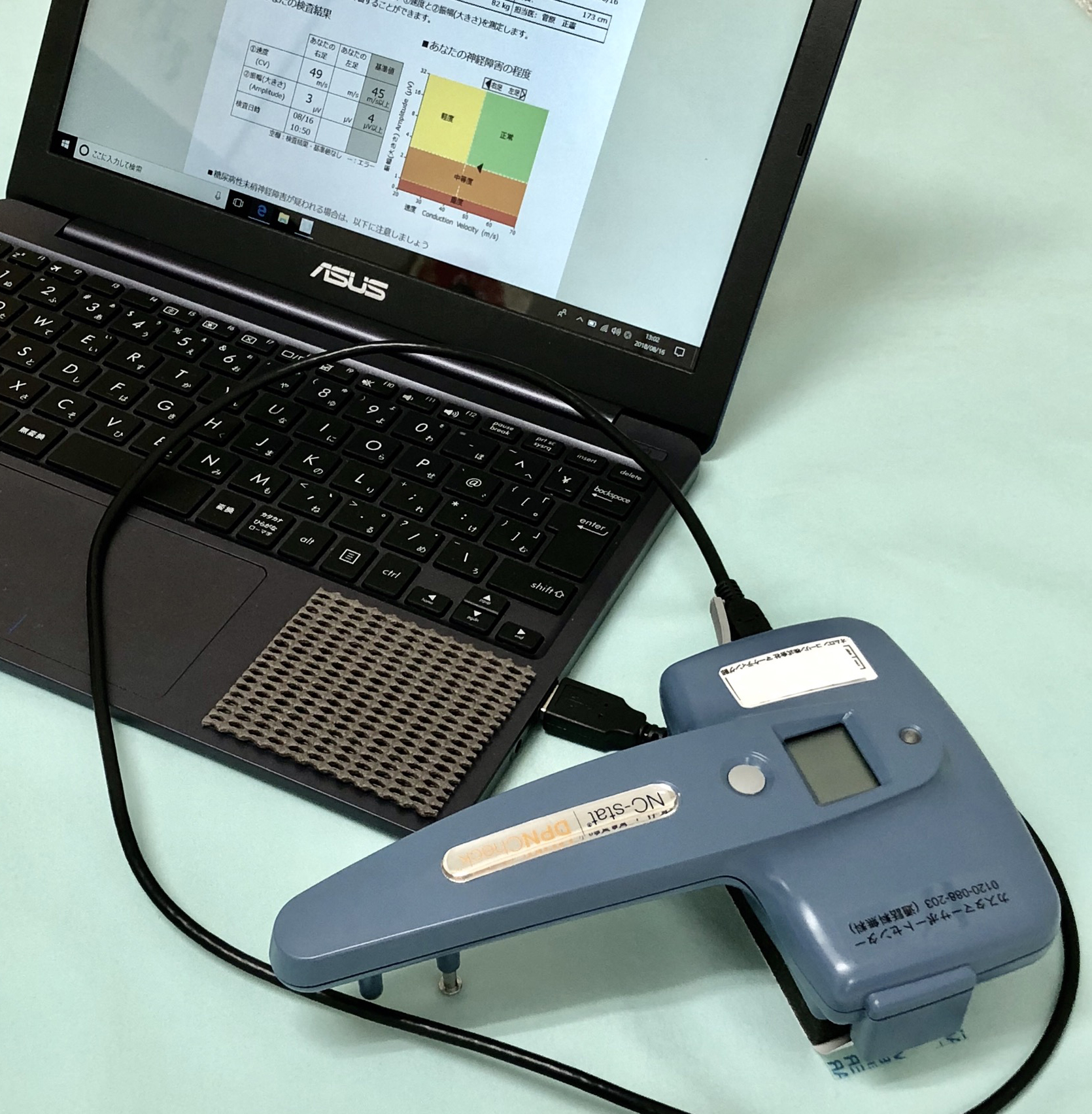 末梢神経障害検査装置（DPN検査）